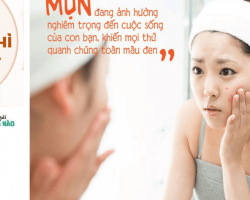 NGUYÊN NHÂN VÀ CÁCH CHĂM SÓC CHO DA MỤN TUỔI DẬY THÌ