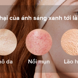 MÀN HÌNH MÁY TÍNH, ĐIỆN THOẠI VÀ NHỮNG TÁC HẠI VỚI LÀN DA