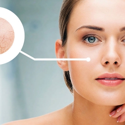 CÁCH DƯỠNG ẨM DÀNH CHO DA KHÔ