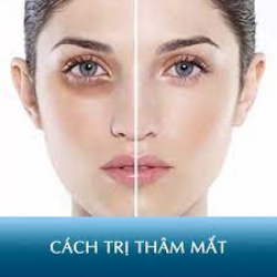 NGUYÊN NHÂN VÀ CÁCH TRỊ THÂM QUẦNG MẮT